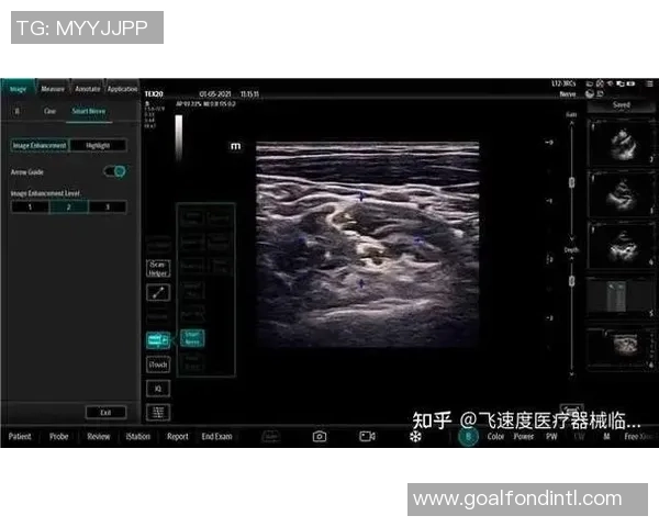西安网球队节奏表现分析与战术优化探讨